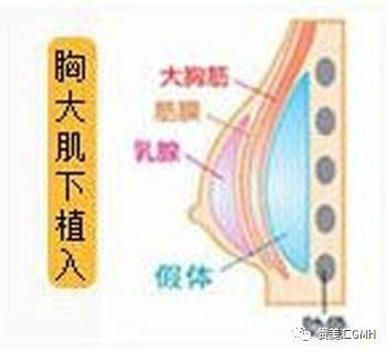 案例图片