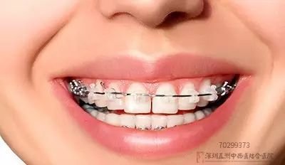 https://img.miyanlife.com/mnt/timg/170925/114133N30-0.jpg