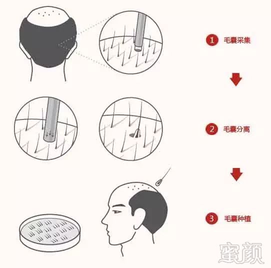 https://img.miyanlife.com/mnt/timg/170926/1240301434-1.jpg