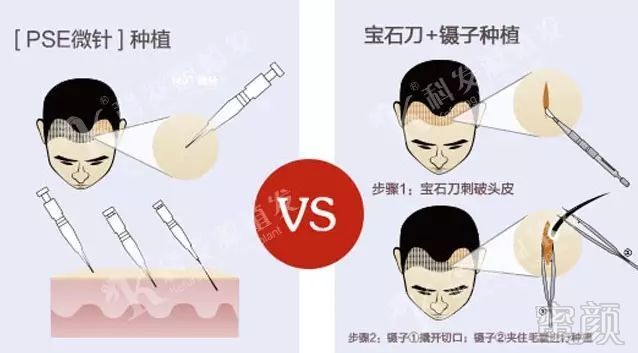 https://img.miyanlife.com/mnt/timg/170926/1249314Y9-3.jpg
