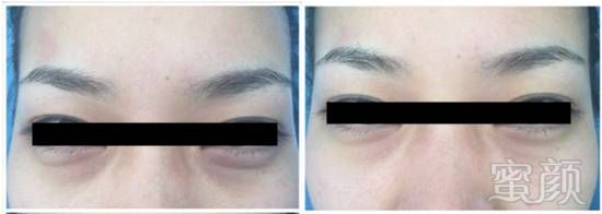 https://img.miyanlife.com/mnt/timg/170926/135Ha544-5.jpg