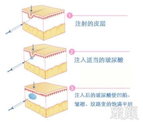 案例图片