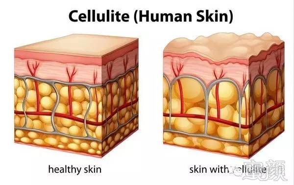 https://img.miyanlife.com/mnt/timg/170927/1134021635-6.jpg