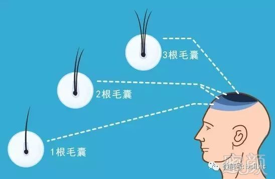 https://img.miyanlife.com/mnt/timg/170927/1319502262-1.jpg