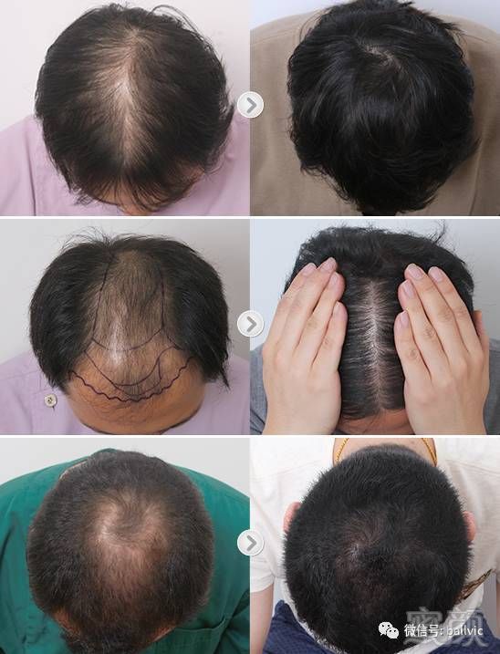 https://img.miyanlife.com/mnt/timg/170927/1319516396-2.jpg
