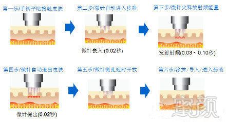 案例图片