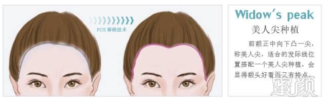 https://img.miyanlife.com/mnt/timg/170928/1316204638-10.jpg
