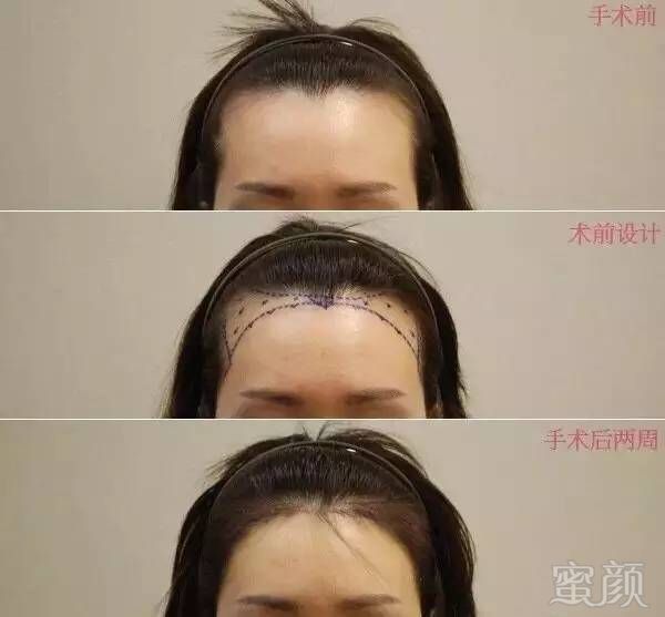 https://img.miyanlife.com/mnt/timg/170928/1316211O7-15.jpg