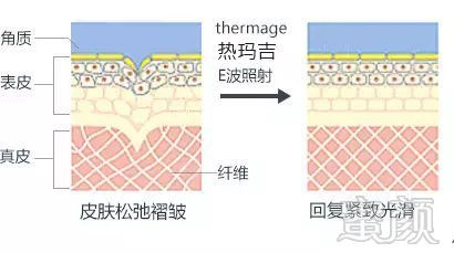 案例图片