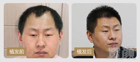 https://img.miyanlife.com/mnt/timg/170928/132K9A92-8.jpg