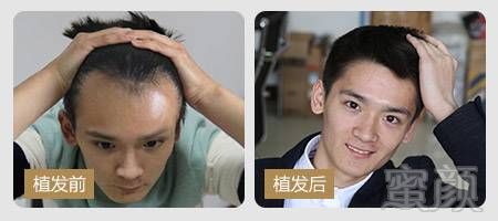 https://img.miyanlife.com/mnt/timg/170928/132KVW9-7.jpg