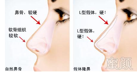 https://img.miyanlife.com/mnt/timg/170928/13421050D-13-j.jpg