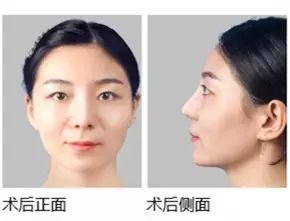 https://img.miyanlife.com/mnt/timg/170928/1345461139-5.jpg