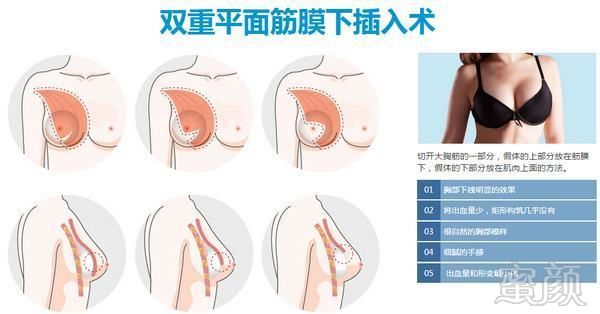 案例图片