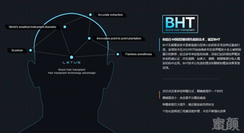 https://img.miyanlife.com/mnt/timg/170928/16302H455-5.jpg