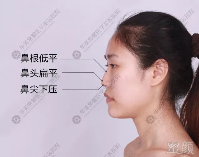 https://img.miyanlife.com/mnt/timg/170928/1G2534447-10.jpg