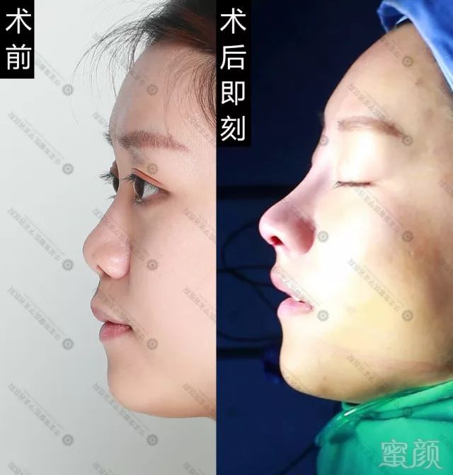 https://img.miyanlife.com/mnt/timg/170928/1G25J109-12.jpg