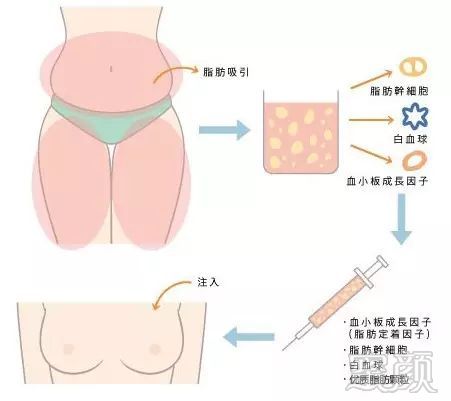 https://img.miyanlife.com/mnt/timg/170928/1PT235Z-6.jpg
