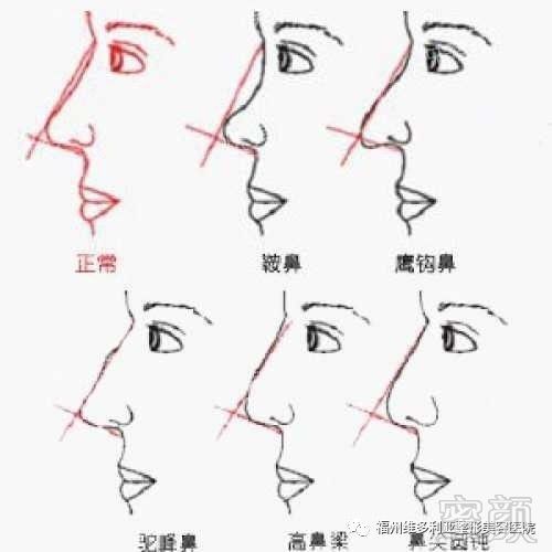 https://img.miyanlife.com/mnt/timg/170928/1Q2162011-1.jpg