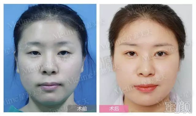 https://img.miyanlife.com/mnt/timg/170929/1409193141-4.jpg