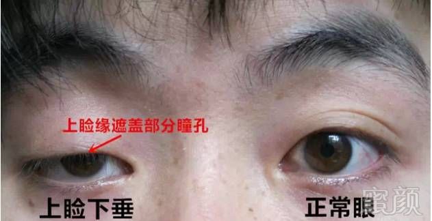 https://img.miyanlife.com/mnt/timg/170929/1409205a0-10.jpg