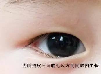 https://img.miyanlife.com/mnt/timg/170929/1409206227-8.jpg