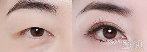 https://img.miyanlife.com/mnt/timg/170929/1409216001-12.jpg