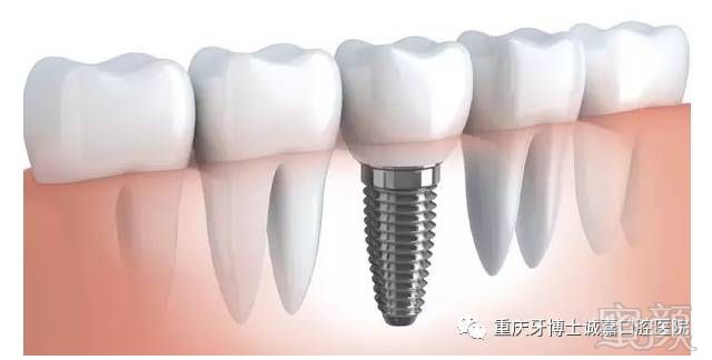 https://img.miyanlife.com/mnt/timg/170929/141U05334-1.jpg