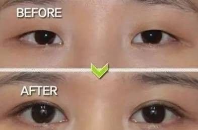 https://img.miyanlife.com/mnt/timg/170930/11313431C-1.jpg