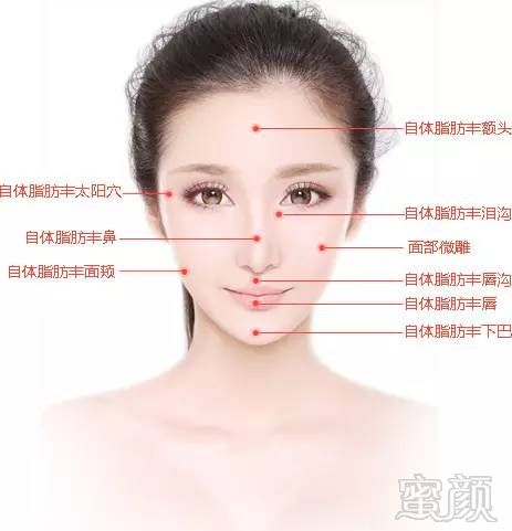https://img.miyanlife.com/mnt/timg/170930/1152043026-8.jpg