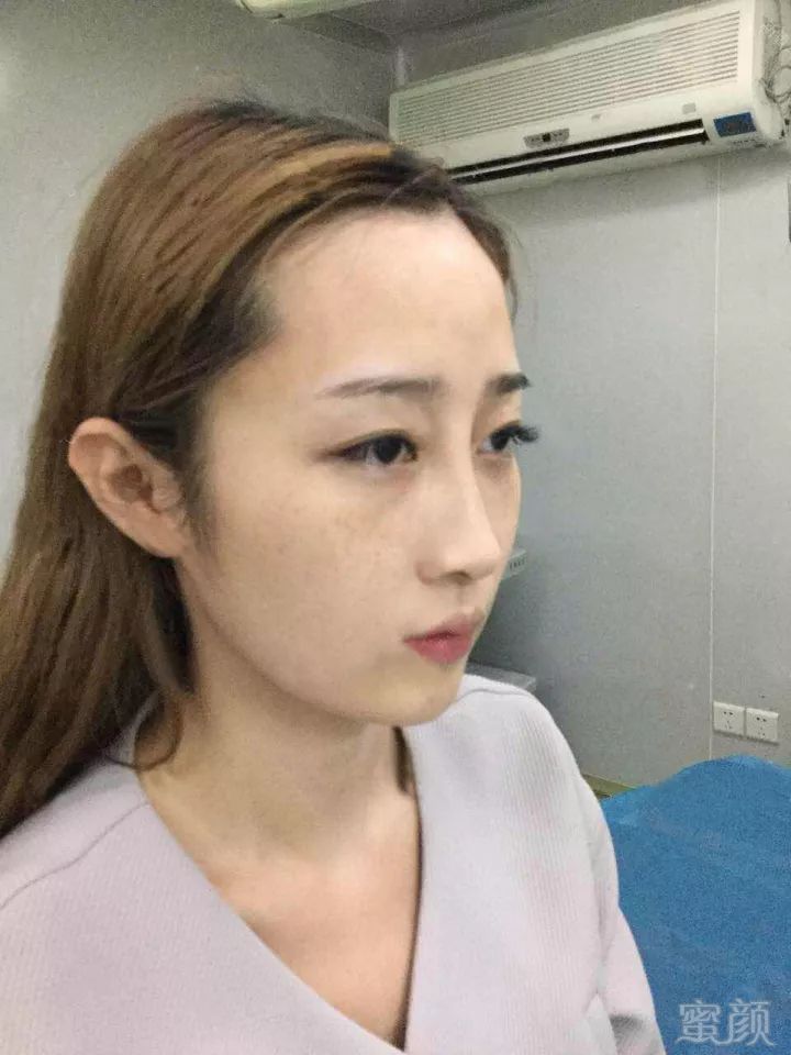 https://img.miyanlife.com/mnt/timg/170930/1204241S0-1.jpg