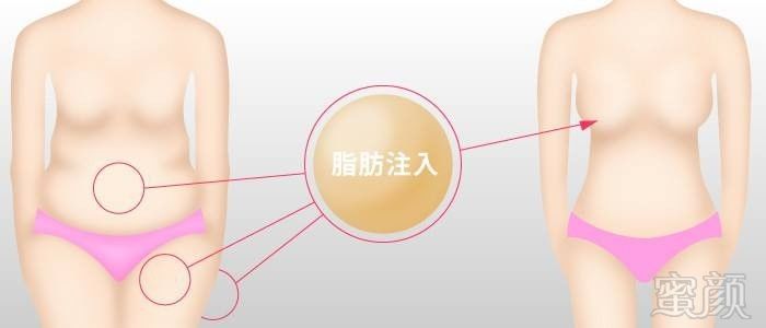 https://img.miyanlife.com/mnt/timg/170930/1G101EO-3.jpg