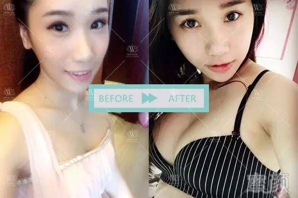 https://img.miyanlife.com/mnt/timg/170930/1G1024492-5.jpg