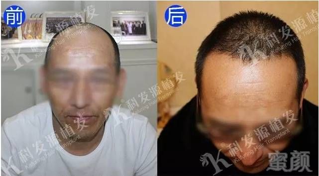 https://img.miyanlife.com/mnt/timg/171001/113Q35Q0-1.jpg