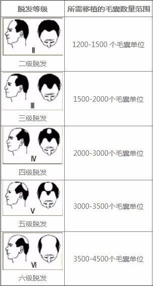 https://img.miyanlife.com/mnt/timg/171001/113Q361X-0.jpg
