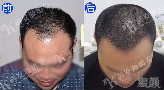 https://img.miyanlife.com/mnt/timg/171001/113Q3DT-2.jpg