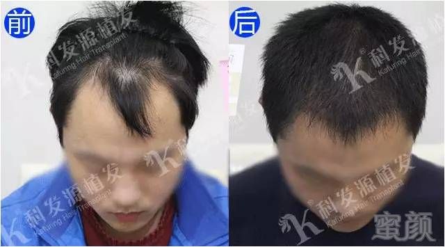 https://img.miyanlife.com/mnt/timg/171001/113Q43c2-4.jpg