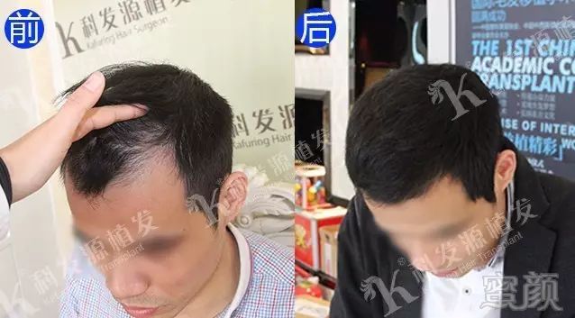 https://img.miyanlife.com/mnt/timg/171001/113Q4N12-5.jpg