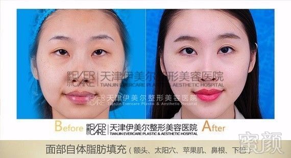https://img.miyanlife.com/mnt/timg/171001/1F253G18-5.jpg