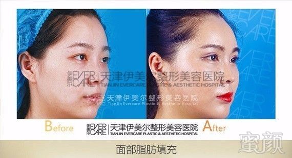 https://img.miyanlife.com/mnt/timg/171001/1F2542054-6.jpg