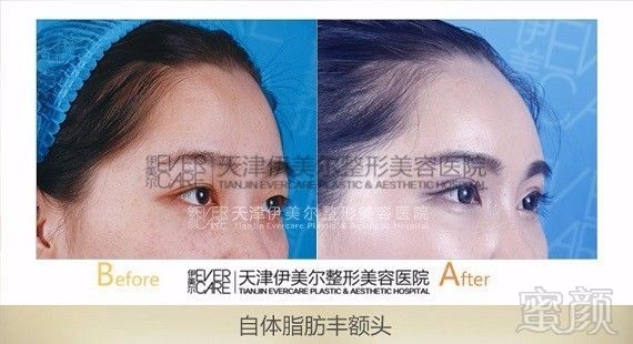https://img.miyanlife.com/mnt/timg/171001/1F254C37-7.jpg