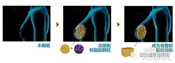 https://img.miyanlife.com/mnt/timg/171001/1F3562010-3.jpg