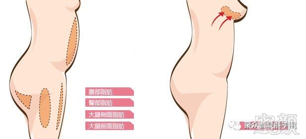 https://img.miyanlife.com/mnt/timg/171001/1F35C037-2.jpg