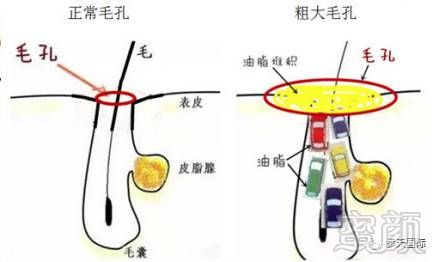 案例图片