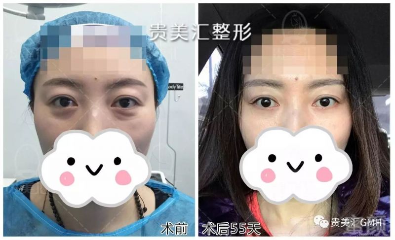 https://img.miyanlife.com/mnt/timg/171002/105Z34950-9.jpg