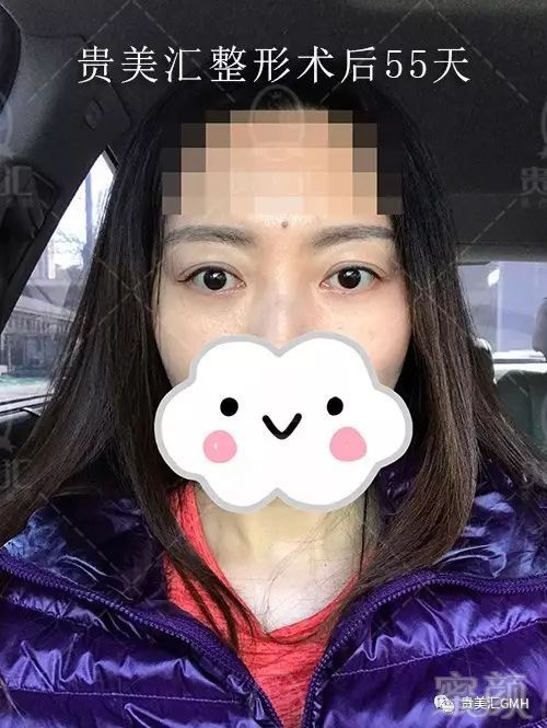 https://img.miyanlife.com/mnt/timg/171002/105Z3O27-11.jpg