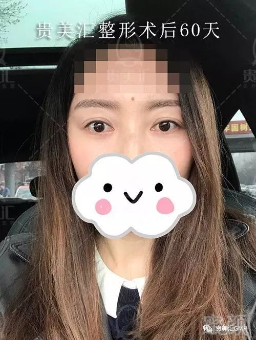 https://img.miyanlife.com/mnt/timg/171002/105Z4OJ-15.jpg