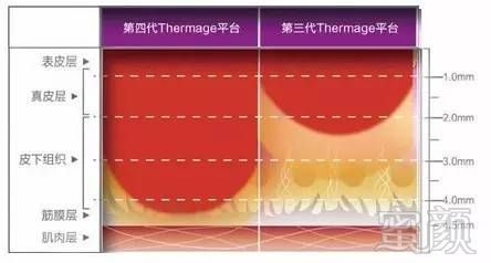 案例图片