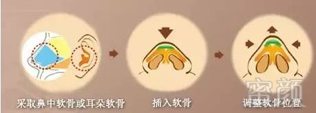 https://img.miyanlife.com/mnt/timg/171002/11400U343-4.jpg