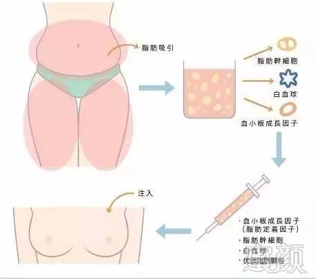 https://img.miyanlife.com/mnt/timg/171003/1100015143-4.jpg